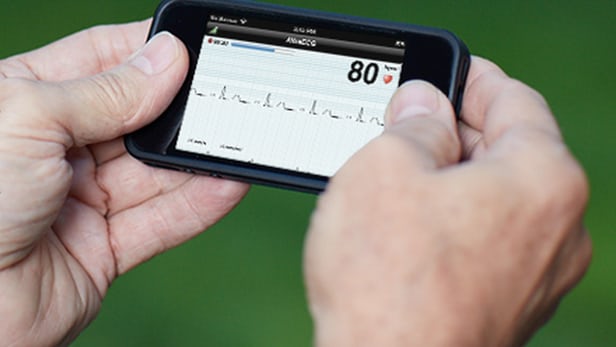 alivecor